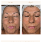 Neutral Before and After Instagram Post